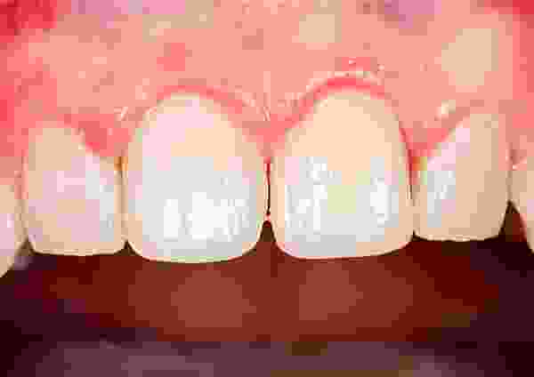 After-Dental-3